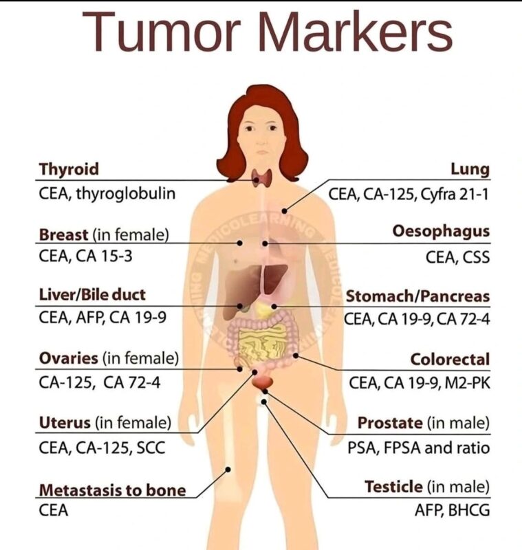 Loay Kassem: The tumor markers are normal - how could I have cancer?