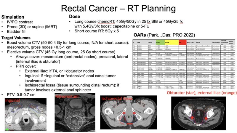 Nina Niu Sanford: Rectal cancer 101 video