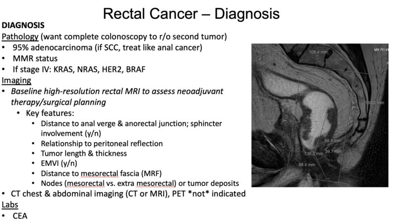 Nina Niu Sanford: Rectal cancer 101 video