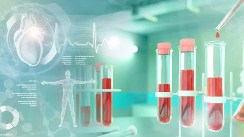 Lung Cancer Network Malaysia (LCNM) has introduced an advanced AI-powered liquid biopsy