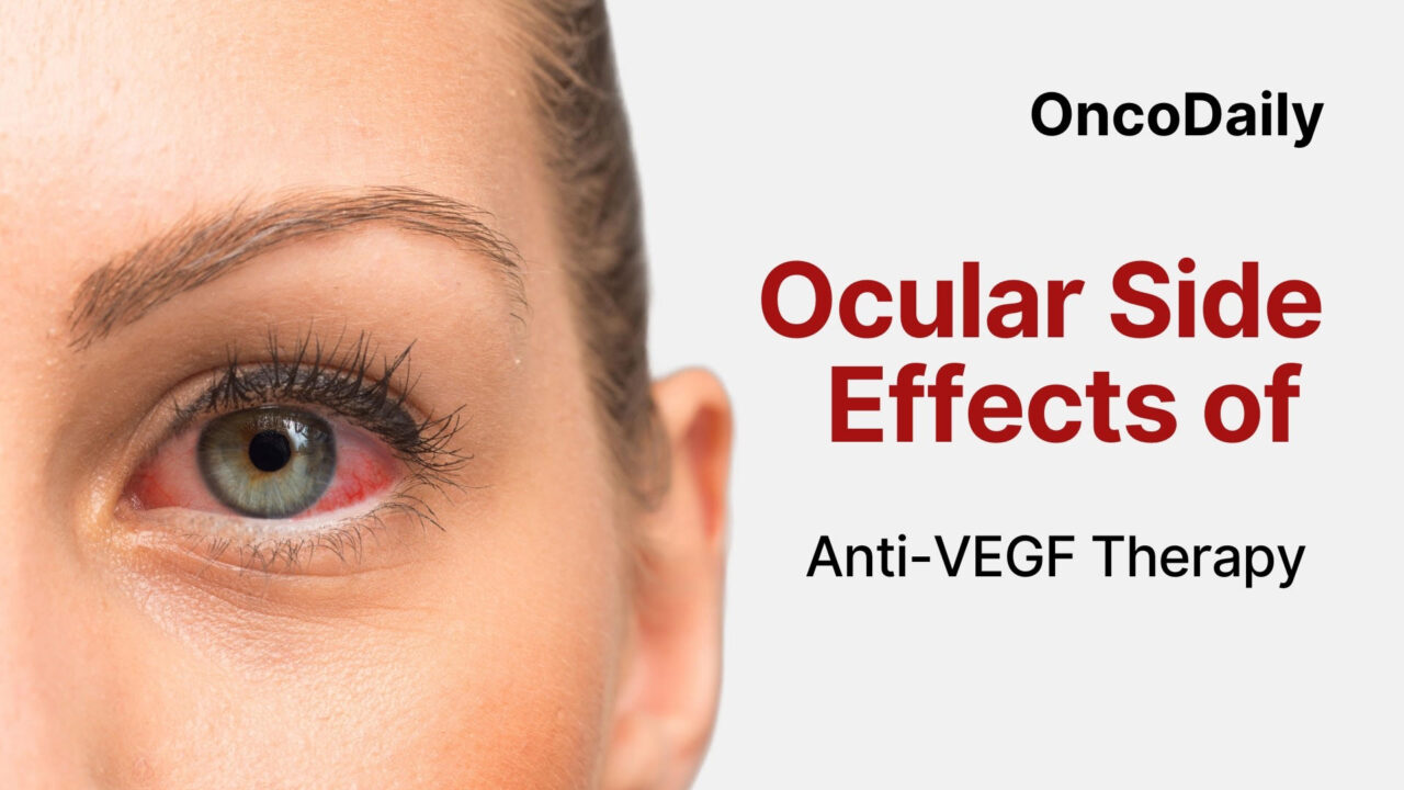 Ocular Side Effects of Anti-VEGF Therapy: From Injection-Related Trauma to Retinal Vasculitis