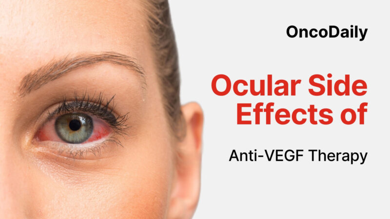 Ocular Side Effects of Anti-VEGF Therapy: From Injection-Related Trauma to Retinal Vasculitis