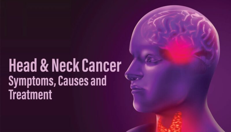 Healthy lifestyle choices lower the risk of head and neck cancers – KESHO