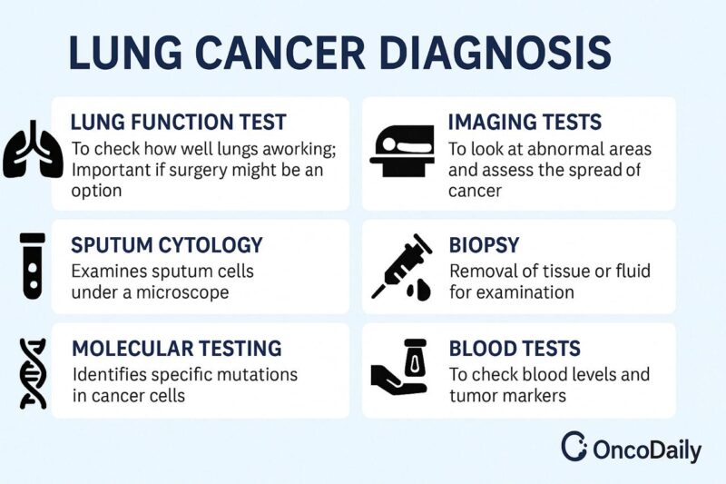 NSCLC-Diagnosis-Oncodaily