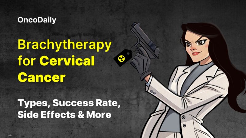 Brachytherapy for Cervical Cancer: Types, Success Rate, Side Effects And More
