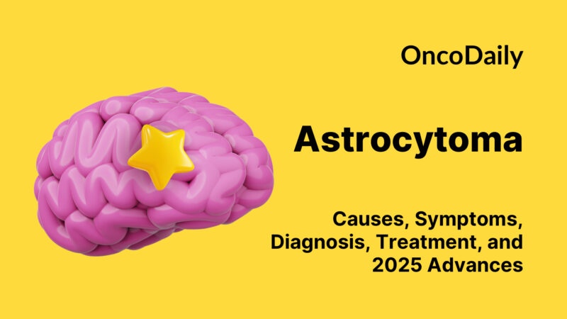 Astrocytoma: Causes, Symptoms, Diagnosis, Treatment, and 2025 Advances