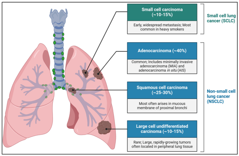 Non-small-cell-lung-cancer