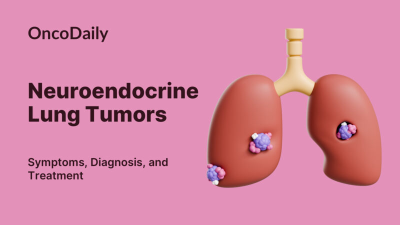 Neuroendocrine Lung Tumors: Types, Symptoms, Diagnosis, Treatment and 2025 updates