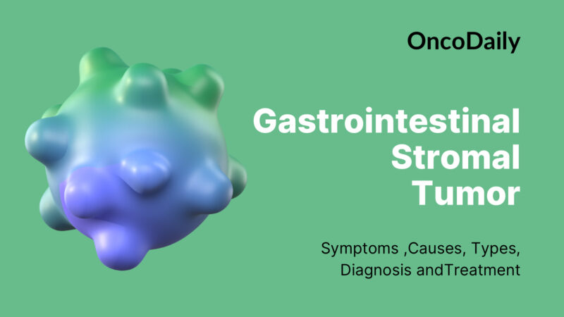 Gastrointestinal Stromal Tumor: Symptoms, Causes, Types, Diagnosis and​ Treatment