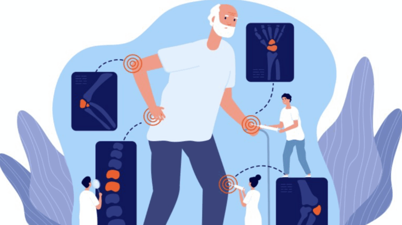 George Vlachogiannis: Modified Glasgow Prognostic Score can reliably predict osteoporosis risk in elderly cancer patients