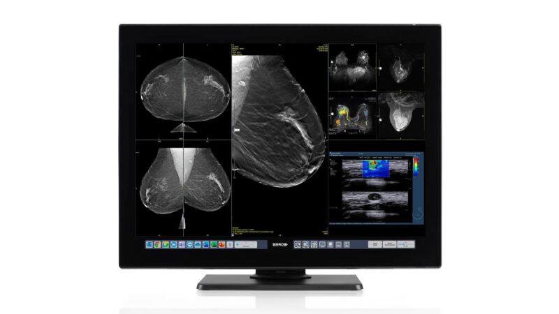Sahar Mansour: Precision and clarity in breast imaging, redefined by Barco’s Coronis OneLook