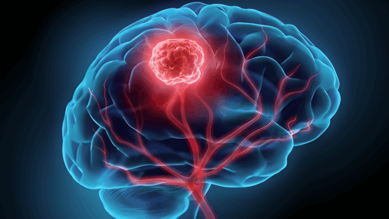 Wafik S. El-Deiry: Pan-cancer human brain metastases atlas at single-cell resolution presentation by Lanlan Zhou