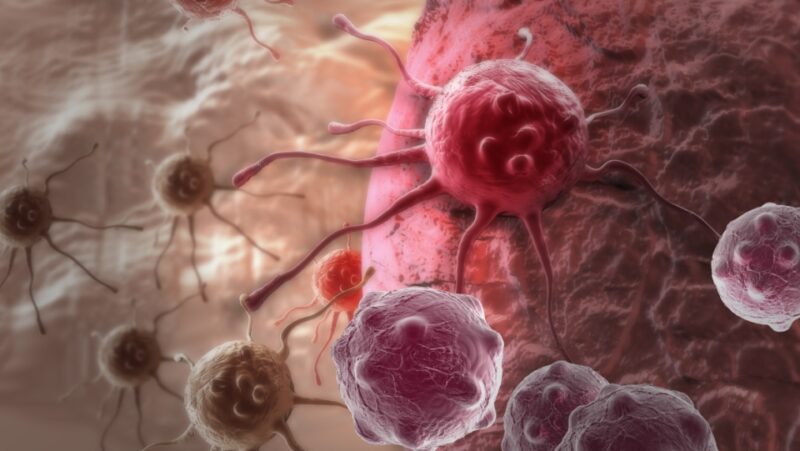 Epidemiology, pathogenesis, biology and evolving management of MSI-H/dMMR cancers