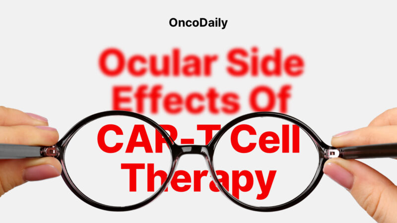 Ocular Side Effects Of CAR-T Cell Therapy