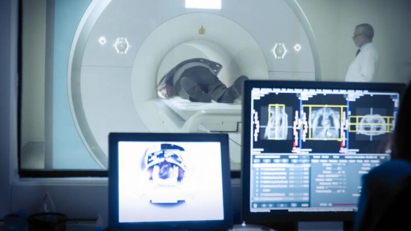 From Lung Cancer Risk to Response – UICC