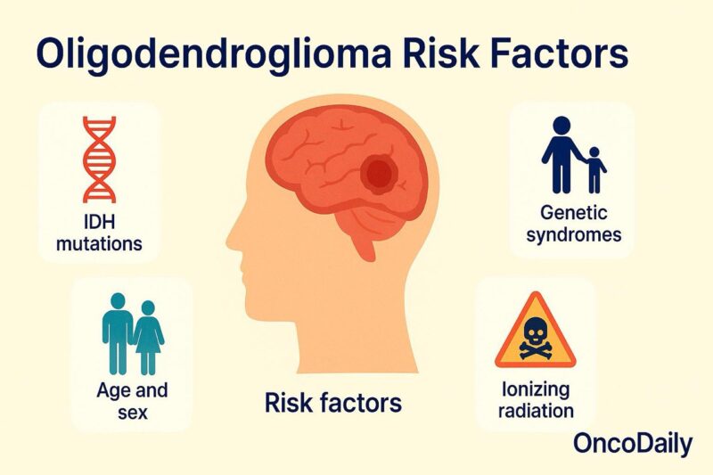 oligodendroglioma