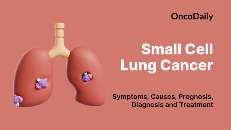 Small Cell Lung Cancer
