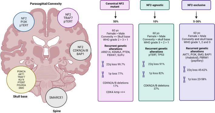 Meningioma