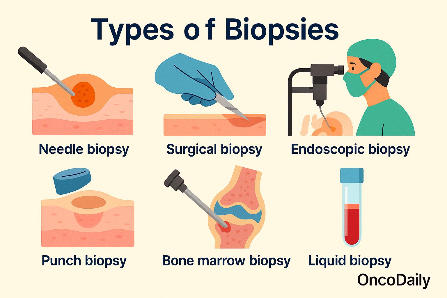 Types of Biopsies