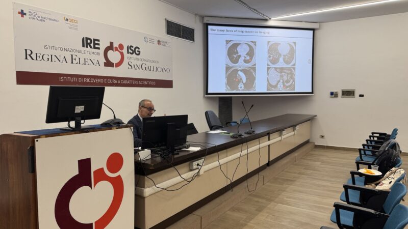 Federico Cappuzzo: Hosting at National Cancer Institute Regina Elena a preceptorship in lung cancer