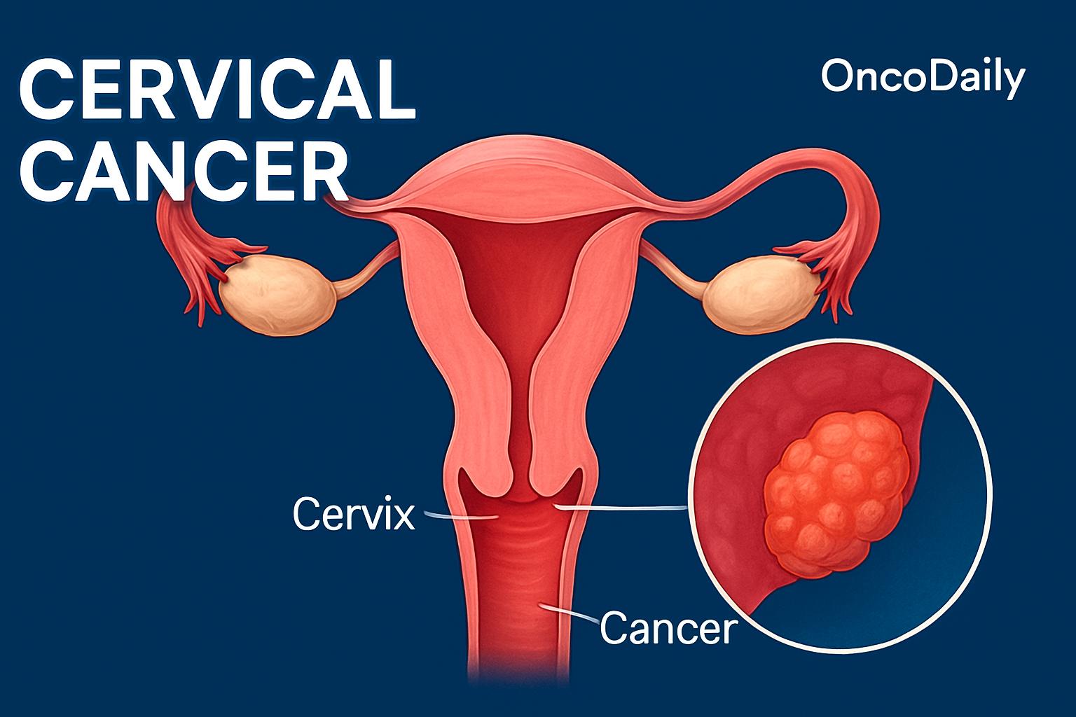 Cervical Cancer