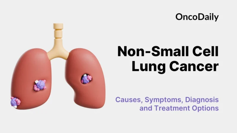 Lung Cancer 