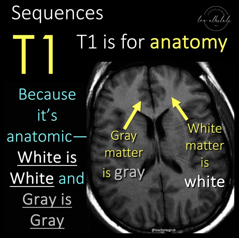 Lea Alhilali: Do Radiologists Sound Like They Are Speaking a Different Language When They Talk About MRI