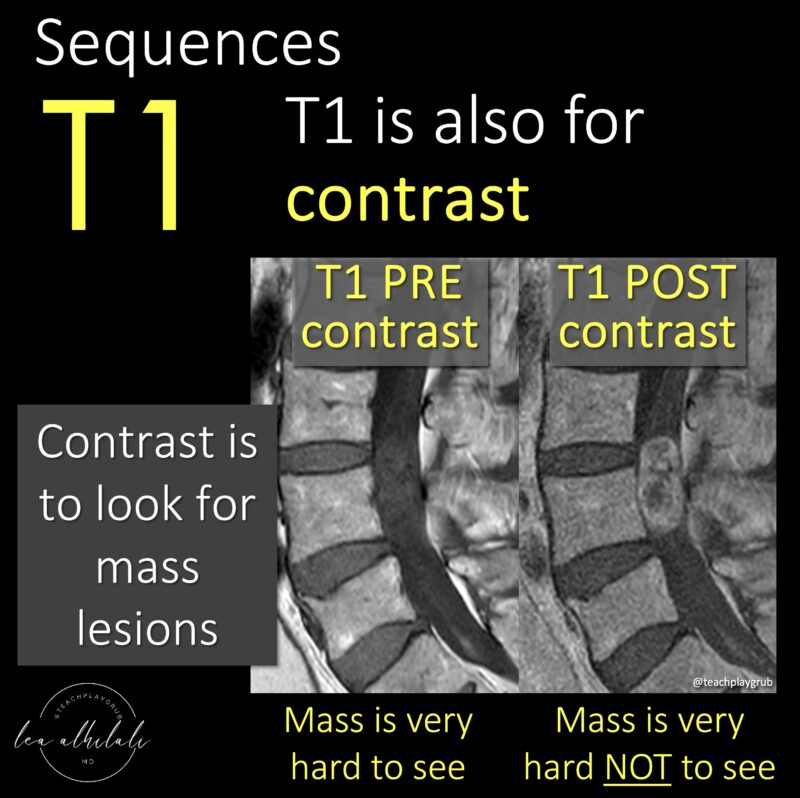 Lea Alhilali: Do Radiologists Sound Like They Are Speaking a Different Language When They Talk About MRI