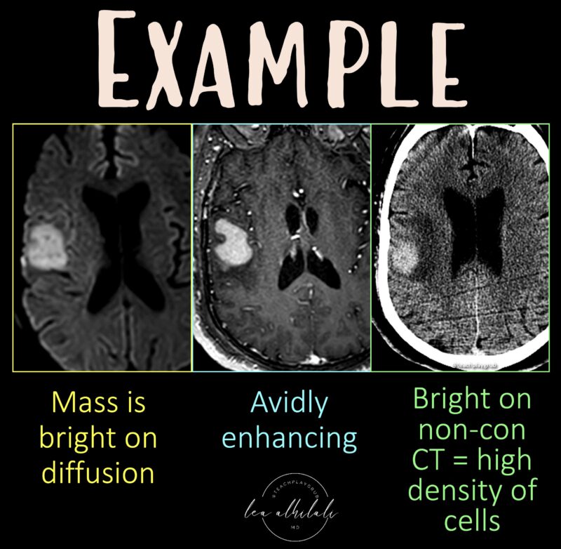 Lea Alhilali: Do Radiologists Sound Like They Are Speaking a Different Language When They Talk About MRI