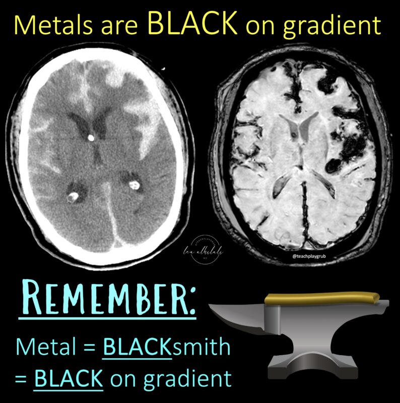 Lea Alhilali: Do Radiologists Sound Like They Are Speaking a Different Language When They Talk About MRI