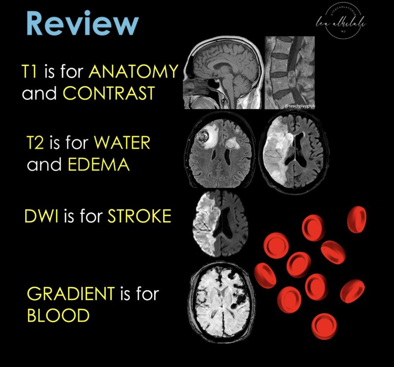 Lea Alhilali: Do Radiologists Sound Like They Are Speaking a Different Language When They Talk About MRI