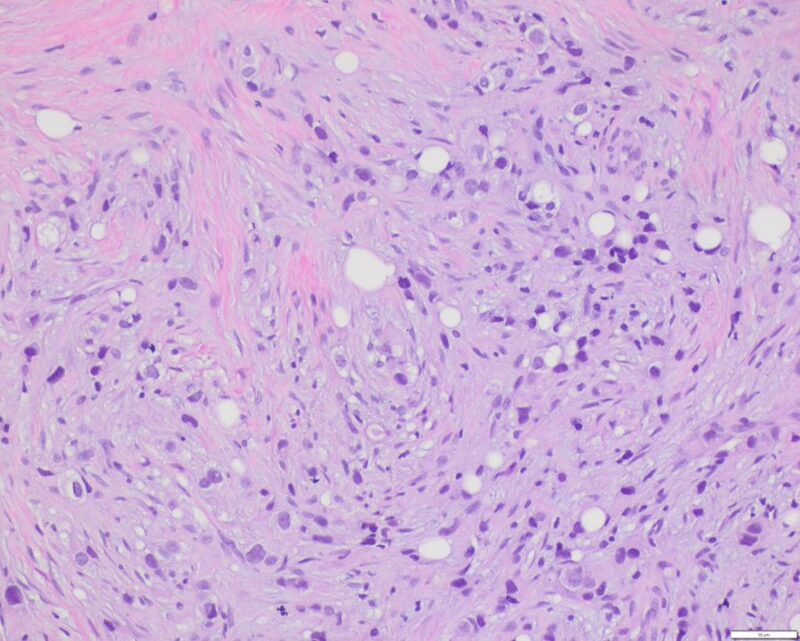 Sanam Loghavi: Hemepath Morphology Challenge