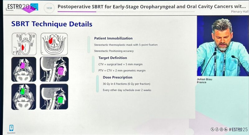 Pierre Blanchard Highlights SBRT as New Option for Small Oral Cavity Cancers