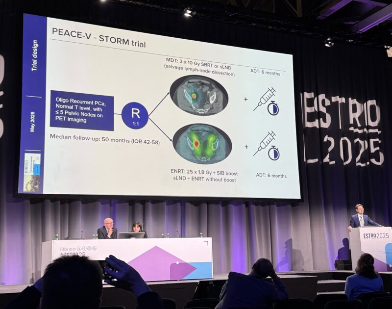 Milos Grujic: First RCT comparing ENRT vs MDT in Oligorecurrent Nodal