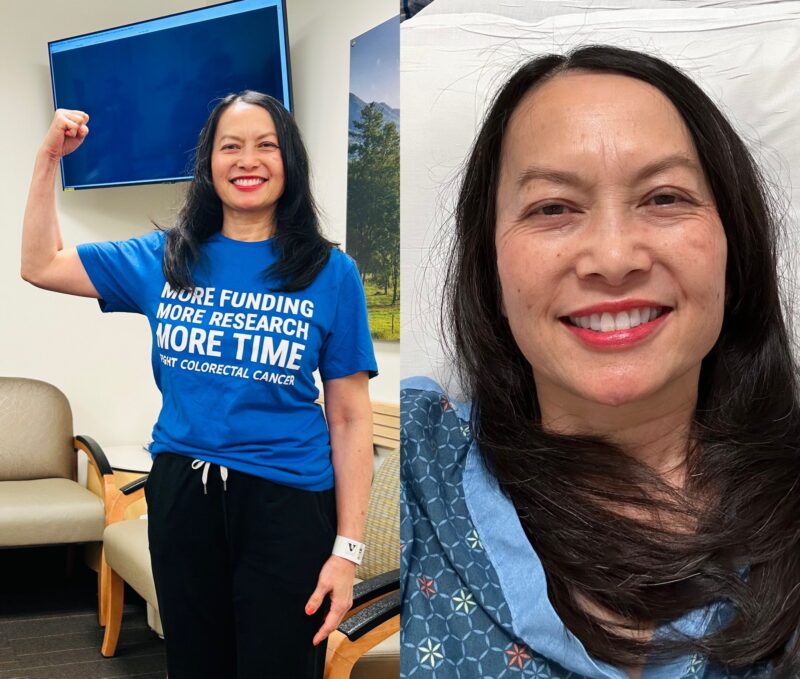 Cathy Eng: Polyps Removed, so Back Again in 3 years