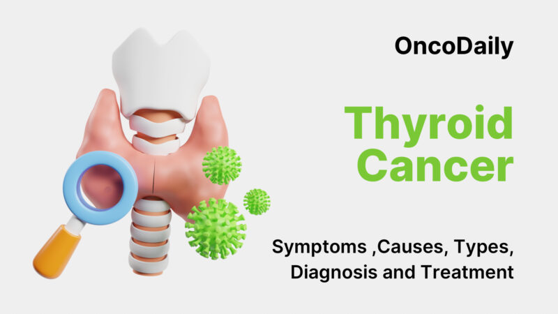 Thyroid Cancer on OncoDaily