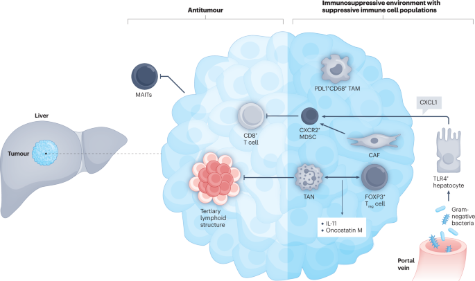 Cholangiocarcinoma 