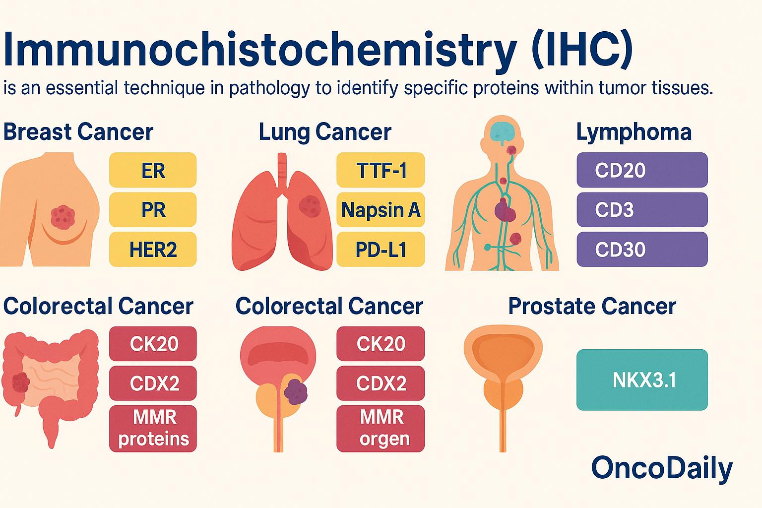 Common IHC Markers in Oncology