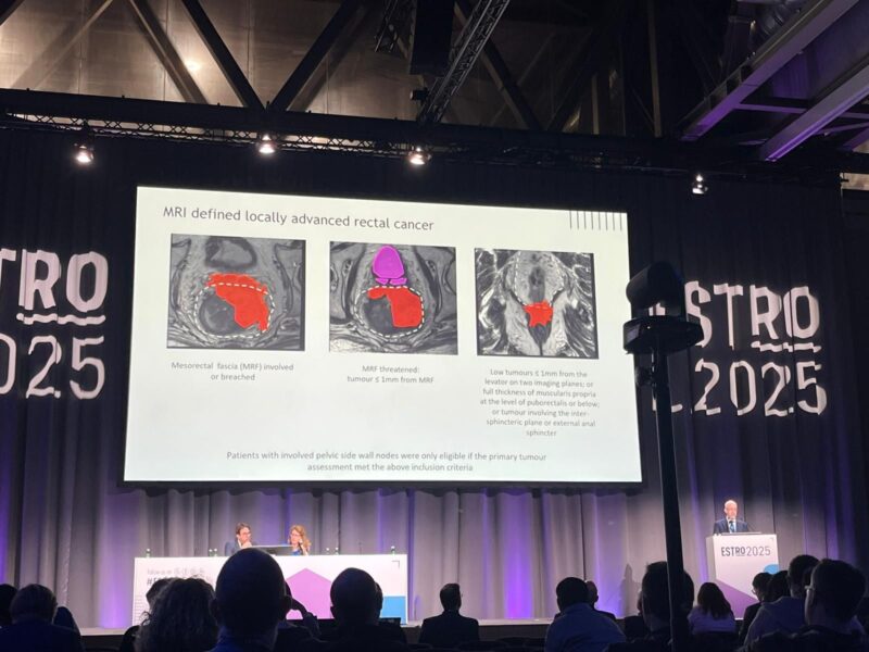 David Sebag-Montefiore Shares ARISTOTLE Rectal Cancer Trial Results at ESTRO25