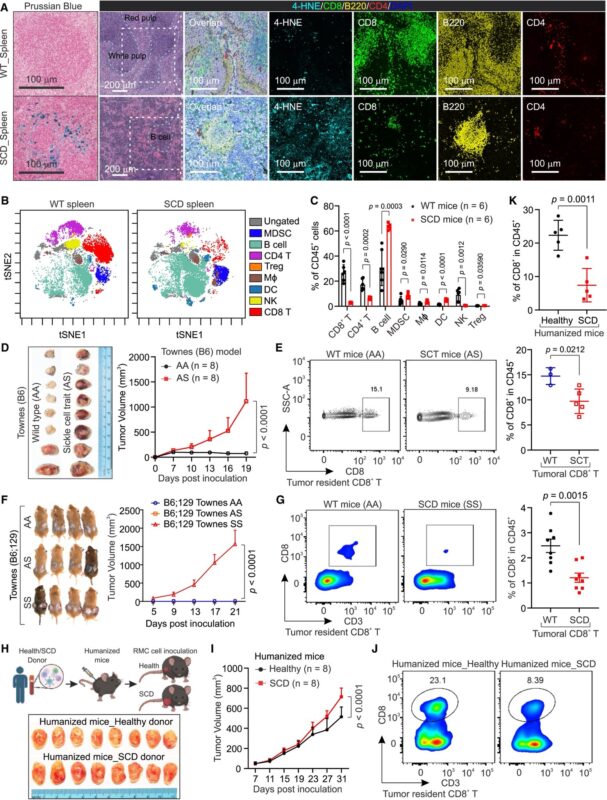 Pavlos Msaouel: SCD induces chromatin introversion and ferroptosis in CD8+ T cells to suppress anti-tumor immunity