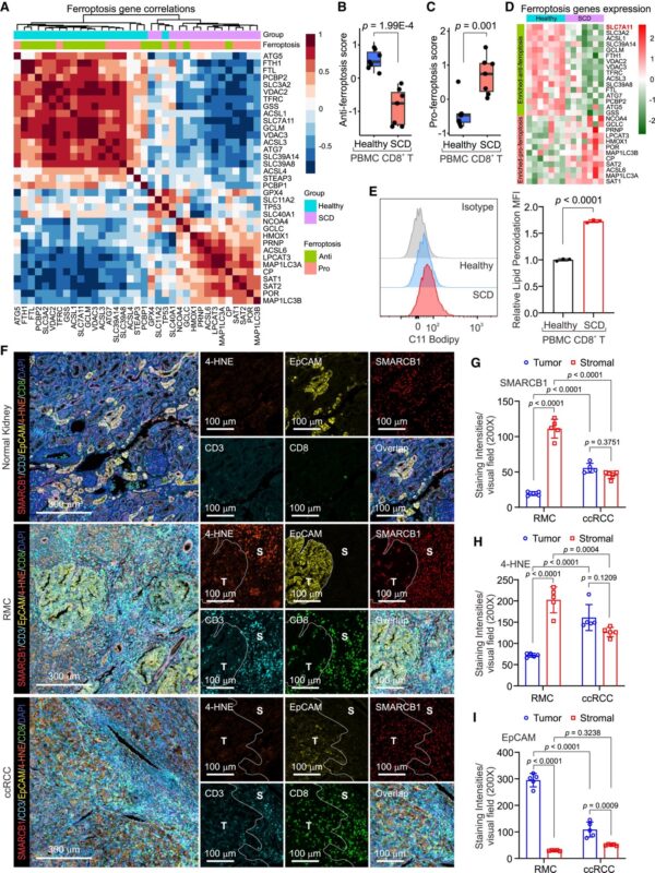Pavlos Msaouel: SCD induces chromatin introversion and ferroptosis in CD8+ T cells to suppress anti-tumor immunity