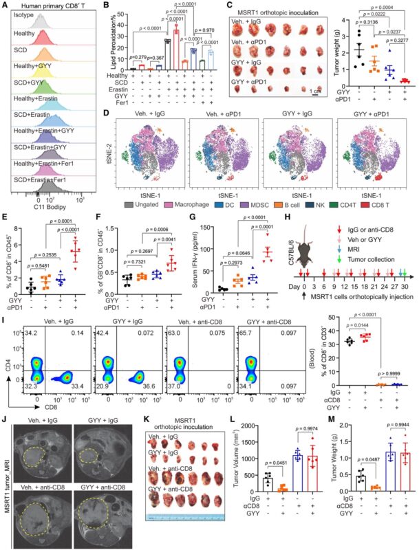 Pavlos Msaouel: SCD induces chromatin introversion and ferroptosis in CD8+ T cells to suppress anti-tumor immunity