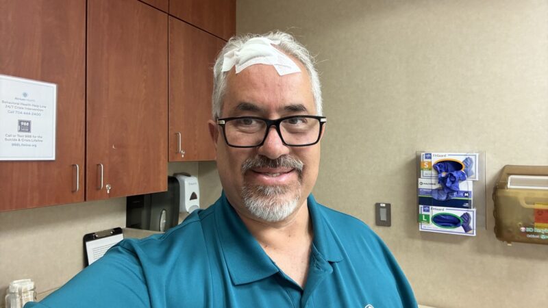 Ruben Mesa: This Year My Perspective on Melanoma and Skin Cancer Awareness Month is Much More Personal