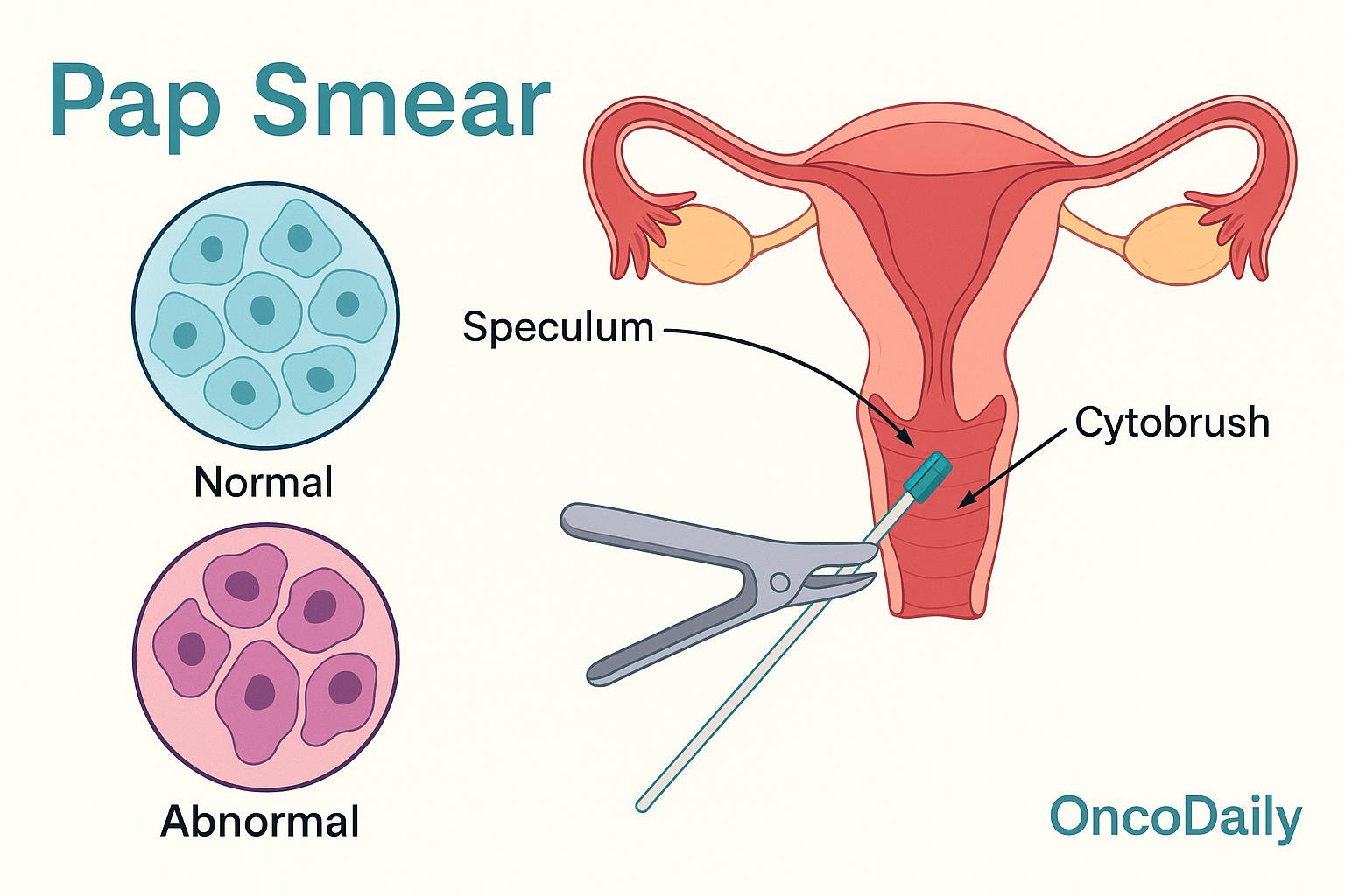 Pap smears