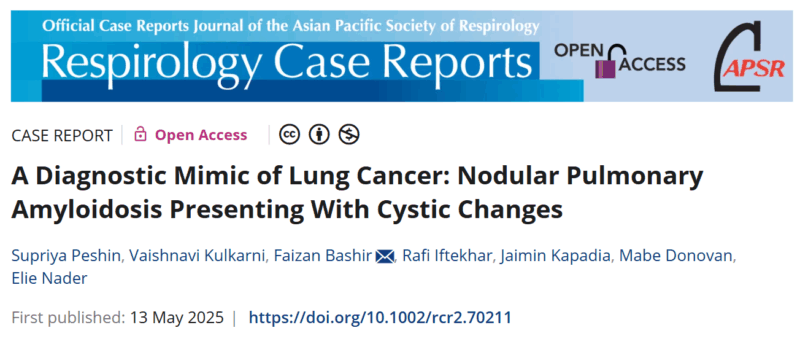 Supriya Peshin: Case Report on Pulmonary Amyloidosis Mimicking Lung Cancer