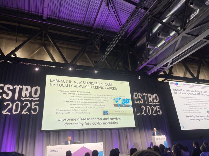 EMBRACE II Trial at ESTRO 2025. Overall Results of on IGRT-IMRT+cisplatin +MR-IGABT in LA Cervix Cancer