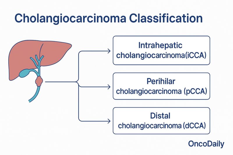 Cholangiocarcinoma 