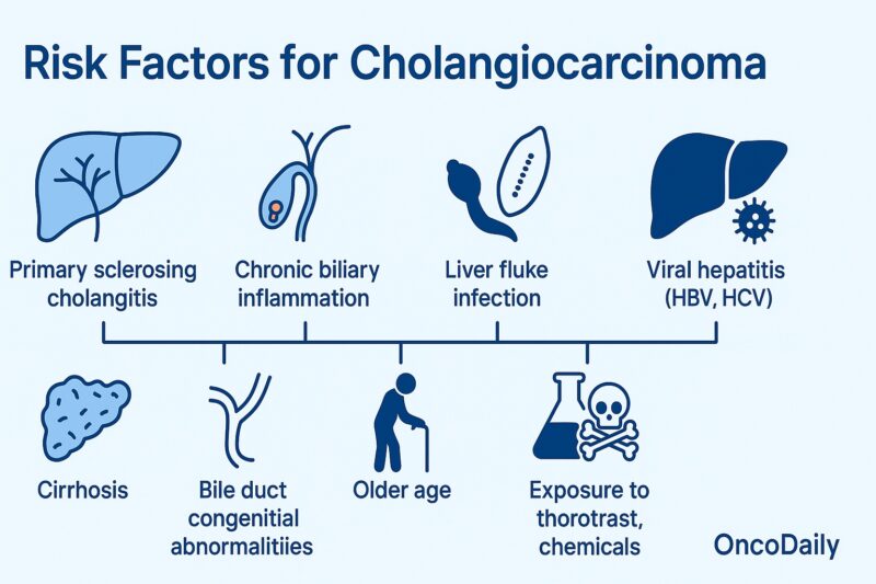 Cholangiocarcinoma 