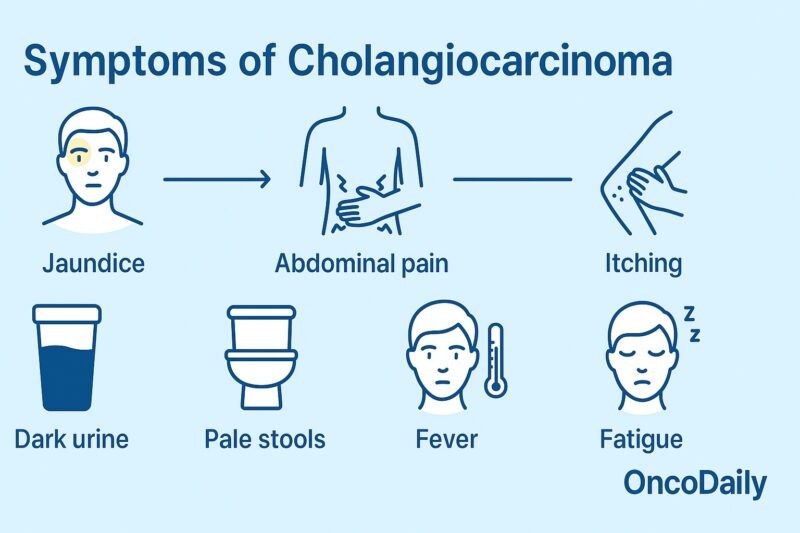 Cholangiocarcinoma 