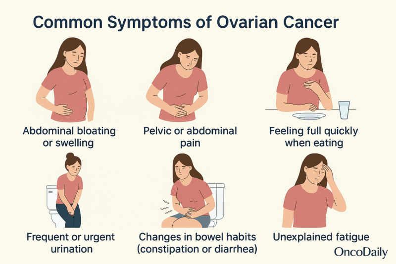 ovarian cancer symptoms